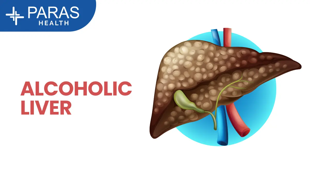 How Alcohol Affects Your Liver